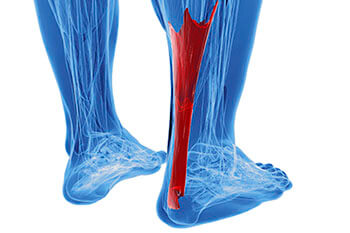 Achilles Tendon Treatment in the in the Manatee County, FL: Bradenton (University Park, Bayshore Gardens, Palmetto, Foxleigh, Lakewood Ranch, Ellenton, Parrish) and Sarasota County, FL: Sarasota (South Gate Ridge, Sarasota Springs, Venice, Laurel, Osprey, Fruitville, South Sarasota, North Sarasota, Southgate, Bee Ridge) areas